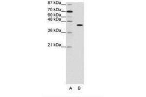 Image no. 1 for anti-PiggyBac Transposable Element Derived 1 (PGBD1) (N-Term) antibody (ABIN202923) (PGBD1 抗体  (N-Term))
