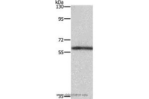 Western blot analysis of Mouse kidney tissue, using TBX5 Polyclonal Antibody at dilution of 1:350