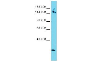 Host: Rabbit Target Name: CCDC141 Sample Type: HepG2 Whole Cell lysates Antibody Dilution: 1. (CCDC141 抗体  (Middle Region))
