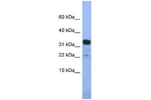 WB Suggested Anti-Klhdc9 Antibody Titration: 1. (KLHDC9 抗体  (Middle Region))