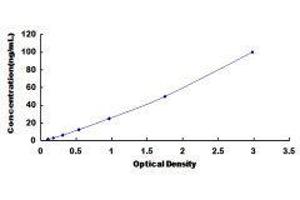 Ferritin, Light Polypeptide (FTL) ELISA Kit