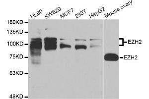 Western blot analysis of extracts of various cell lines, using EZH2 antibody. (EZH2 抗体)