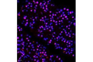 Immunofluorescence of paraffin embedded rat pancreas using ALS2CR13 (ABIN7073909) at dilution of 1:650 (400x lens) (FAM117B 抗体)