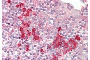 Immunohistochemistry (IHC) image for anti-Small Nuclear Ribonucleoprotein D1 Polypeptide 16kDa (SNRPD1) (N-Term) antibody (ABIN2779015)
