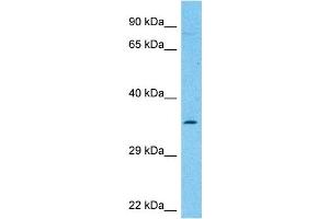 Host:  Rabbit  Target Name:  NCEH1  Sample Type:  THP-1 Whole Cell lysates  Antibody Dilution:  1. (NCEH1 抗体  (C-Term))