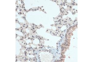 Immunohistochemistry of paraffin-embedded Mouse lung using Thioredoxin 1 (Trx1/Thioredoxin 1 (Trx1/TXN)) antibody (ABIN7270798) at dilution of 1:100 (40x lens). (TXN 抗体  (C-Term))