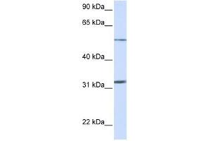 SLC35A5 antibody used at 1 ug/ml to detect target protein. (SLC35A5 抗体  (N-Term))