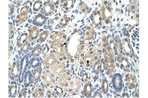 Immunohistochemistry (IHC) image for anti-Nicotinamide phosphoribosyltransferase (NAMPT) (C-Term) antibody (ABIN629601)