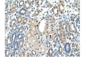 PBEF1 antibody was used for immunohistochemistry at a concentration of 4-8 ug/ml to stain Epithelial cells of renal tubule (arrows) in Human Kidney. (NAMPT 抗体  (C-Term))