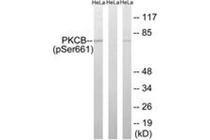 Western blot analysis of extracts from HeLa cells treated with heat shock, using PKCB (Phospho-Ser661) Antibody. (PKC beta 抗体  (pSer661))