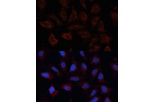 Immunofluorescence analysis of U2OS cells using  antibody (ABIN6129706, ABIN6136901, ABIN6136902 and ABIN6214776) at dilution of 1:100. (ANO1 抗体  (AA 628-731))