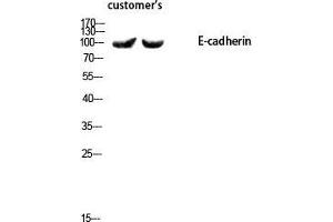 Western Blot (WB) analysis of using E-cadherin Polyclonal Antibody. (E-cadherin 抗体  (N-Term))