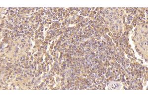 Detection of PF4 in Human Spleen Tissue using Monoclonal Antibody to Platelet Factor 4 (PF4) (PF4 抗体  (AA 31-101))