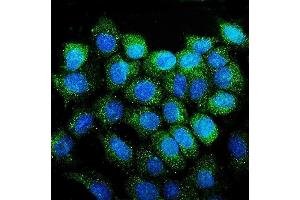 IF analysis of CD38 using anti-CD38 antibody (ABIN7602815).