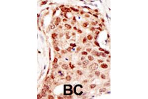 Immunohistochemistry (IHC) image for anti-Cbl proto-oncogene C (CBLC) antibody (ABIN2996838) (CBLC 抗体)
