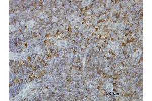 Immunoperoxidase of monoclonal antibody to HLA-DPB1 on formalin-fixed paraffin-embedded human lymph node.