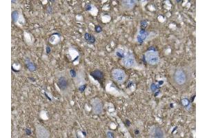 IHC analysis of NEFL/NF-L using anti-NEFL/NF-L antibody (ABIN7601626).