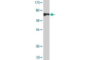 Western Blot detection against Immunogen (75. (CDR2 抗体  (AA 1-454))