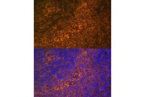 Immunofluorescence analysis of rat spleen using TNFRSF10A Polyclonal Antibody (ABIN6127583, ABIN6149301, ABIN6149303 and ABIN6216204) at dilution of 1:100 (40x lens). (TNFRSF10A 抗体  (AA 269-468))