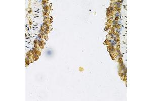 Immunohistochemistry (Paraffin-embedded Sections) (IHC (p)) image for anti-Heat Shock Protein 90kDa alpha (Cytosolic), Class B Member 1 (HSP90AB1) (AA 1-300) antibody (ABIN3021406)