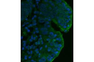 IF analysis of CD55 using anti-CD55 antibody (ABIN7601422).