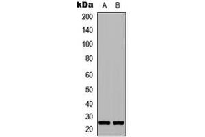 Western blot analysis of FGF17 expression in NS-1 (A), PC12 (B) whole cell lysates.