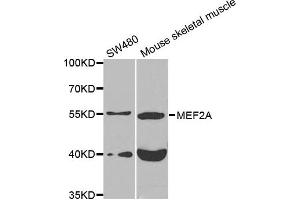 Western blot analysis of extracts of various cell lines, using MEF2A antibody. (MEF2A 抗体)