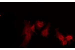 ABIN6272385 staining Hela by IF/ICC. (Peropsin 抗体  (Internal Region))