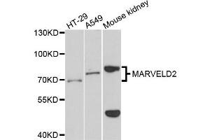 Western blot analysis of extracts of various cells, using MARVELD2 antibody. (Tricellulin 抗体)