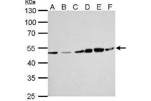 Western Blotting (WB) image for anti-Excision Repair Cross-Complementing Rodent Repair Deficiency, Complementation Group 8 (ERCC8) (Internal Region) antibody (ABIN2857082)