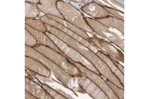 Immunohistochemical staining of human skeletal muscle with MURC polyclonal antibody  shows distinct cytoplasmic and membranous positivity in myocytes at 1:500-1:1000 dilution. (MURC 抗体)