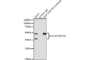 Immunoprecipitation analysis of 600 μg extracts of Mouse brain using 3 μg GLUT3/SLC2 antibody (ABIN7270415). (SLC2A3 抗体)