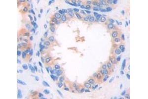 Used in DAB staining on fromalin fixed paraffin- embedded Kidney tissue (DOK3 抗体  (AA 45-310))