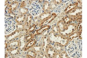 Immunohistochemical staining of rabbit kidney using anti-syntaxin antibody ABIN7072248 Formalin fixed rabbit kidney slices were were stained with ABIN7072248 at 3 μg/mL. (Recombinant Syntaxin 抗体)
