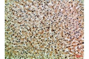 Immunohistochemical analysis of paraffin-embedded Human-liver, antibody was diluted at 1:100 (PPP1R13B 抗体  (AA 630-680))