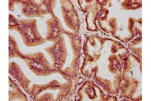 IHC image of ABIN7160369 diluted at 1:400 and staining in paraffin-embedded human prostate tissue performed on a Leica BondTM system.