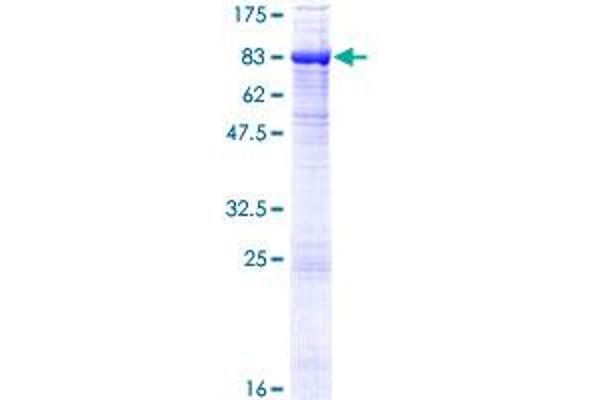 Tyrosinase-Related Protein 1 Protein (TYRP1) (AA 1-537) (GST tag)