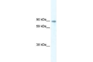 WB Suggested Anti-STAT5B Antibody Titration:  5. (STAT5B 抗体  (Middle Region))