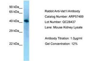 Image no. 1 for anti-Vesicle Amine Transport 1-Like (VAT1L) (AA 80-129) antibody (ABIN6749938) (VAT1L 抗体  (AA 80-129))