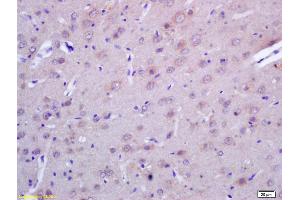Formalin-fixed and paraffin embedded rat brain labeled with Rabbit Anti ACTH (1-39) Polyclonal Antibody, Unconjugated (ABIN668676) at 1:200 followed by conjugation to the secondary antibody and DAB staining (ACTH 抗体  (AA 1-39))