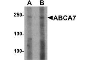 Western blot analysis of ABCA7 in 293 cell lysate with ABCA7 antibody at (A) 1 and (B) 2 ug/mL. (ABCA7 抗体  (N-Term))