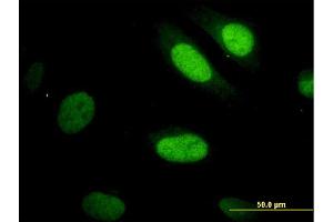 Immunofluorescence (IF) image for anti-Yes-Associated Protein 1 (YAP1) (AA 53-161) antibody (ABIN564526)