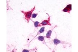 Anti-GPR182 / ADMR antibody immunocytochemistry (ICC) staining of HEK293 human embryonic kidney cells transfected with GPR182 / ADMR. (G Protein-Coupled Receptor 182 抗体  (N-Term))