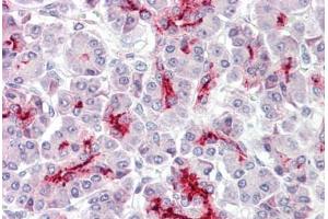 Immunohistochemistry (IHC) image for anti-Caudal Type Homeobox 2 (CDX2) (AA 1-60) antibody (ABIN1100745)