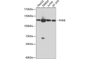 Western blot analysis of extracts of various cell lines using PHKB Polyclonal Antibody at dilution of 1:1000. (PHKB 抗体)