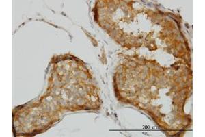 Image no. 1 for anti-Cold Shock Domain Containing C2, RNA Binding (CSDC2) (AA 1-154) antibody (ABIN466198) (CSDC2 抗体  (AA 1-154))