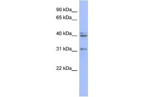 WB Suggested Anti-PABPN1 Antibody Titration: 0. (PABPN1 抗体  (N-Term))