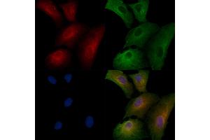 ABIN6258204 and ABIN6273883 staining  cells by IF/ICC.