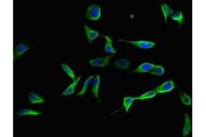 Immunofluorescent analysis of Hela cells using ABIN7151432 at dilution of 1:100 and Alexa Fluor 488-congugated AffiniPure Goat Anti-Rabbit IgG(H+L) (FBLN3 抗体  (AA 27-184))
