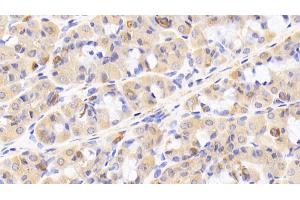 Detection of TLR5 in Human Stomach Tissue using Polyclonal Antibody to Toll Like Receptor 5 (TLR5) (TLR5 抗体  (AA 303-514))